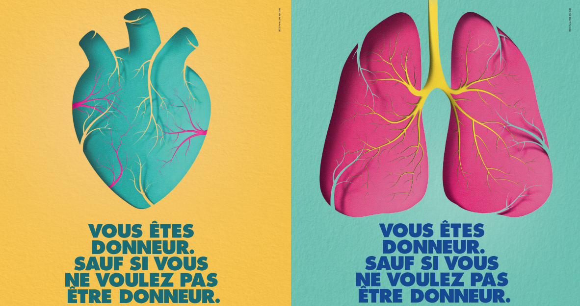 Don d’organes : est-on obligé de tout donner ?