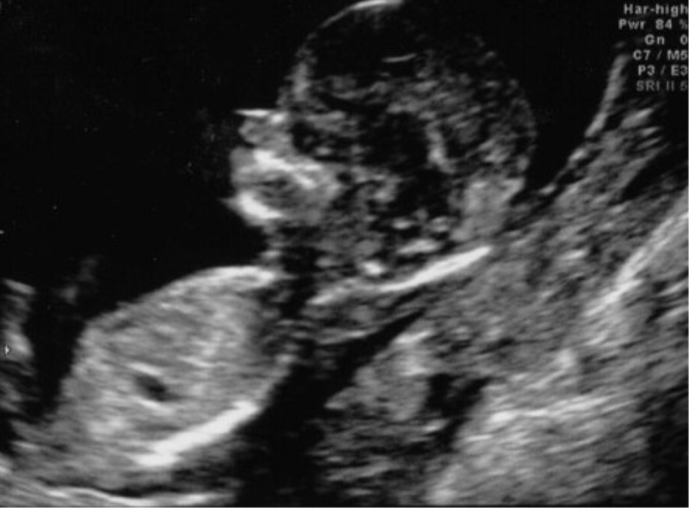 L’essentiel de l’actualité en France du 5 au 11 octobre 2019